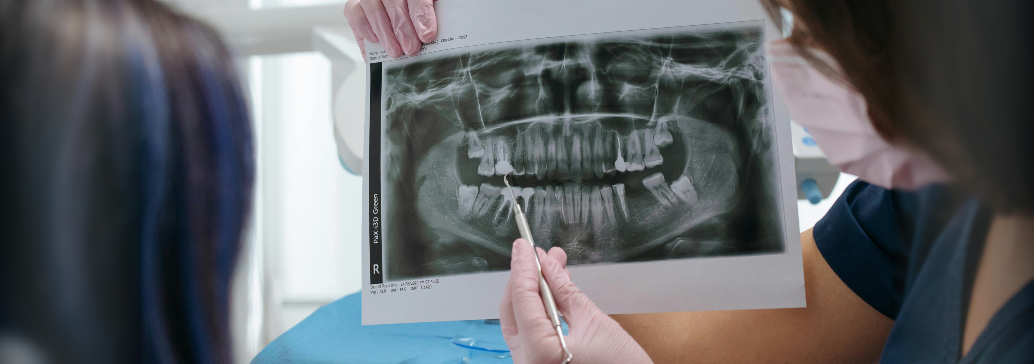 A patient in a dental chair being shown x-rays from a dental practitioner.